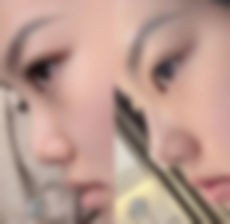 【沈阳小树医疗美容特色项目】