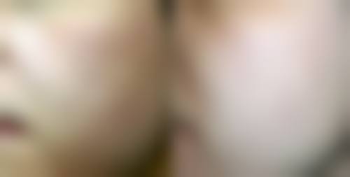 瘦脸针可以一直打下去吗