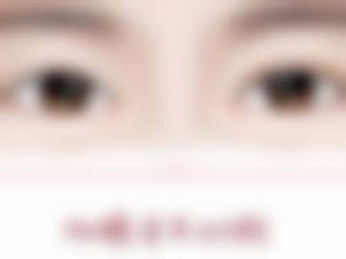 植发后如何减少掉发?