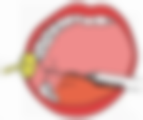 头发种植价格一般多少钱