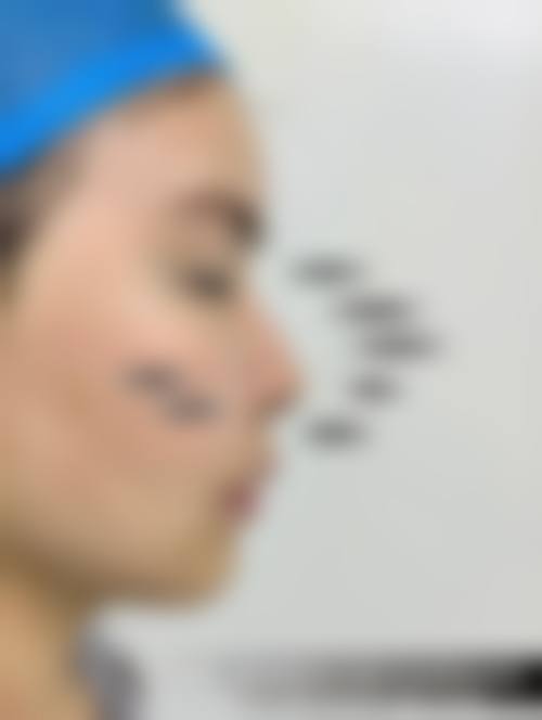 青岛市朱洪涛和张宇恒在青岛瑧妍美医疗美容医院的口碑如何?