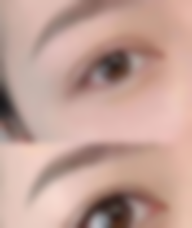 种植完头发还会掉吗?