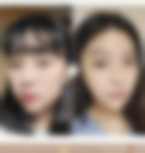 瘦脸针打一次维持多久