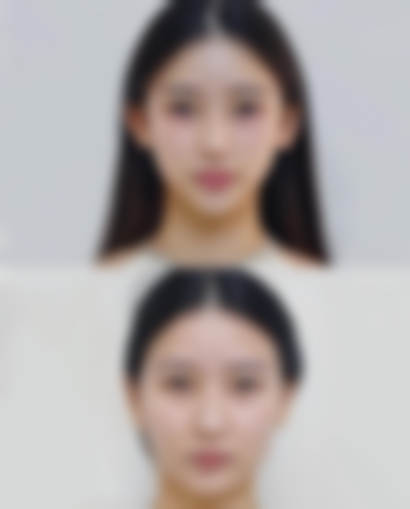 瘦脸针在哪里打