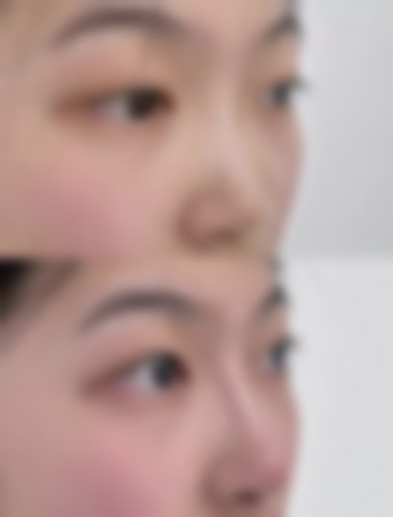 种植头发的成效能保持多久