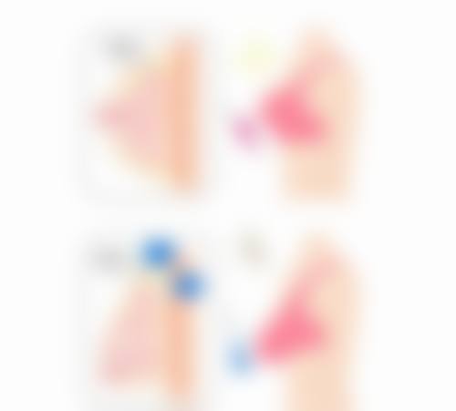 阴道粘膜损伤怎么治愈