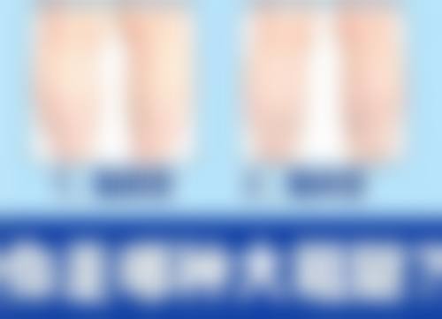 阴道粘膜修复有用吗