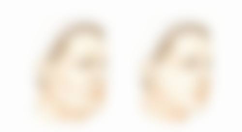 打瘦脸针有后遗症吗