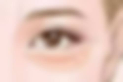 打瘦脸针凹陷了怎么办？掌握这5大修复秘诀，快速改善凹陷问题，重获紧致饱满脸型！ 