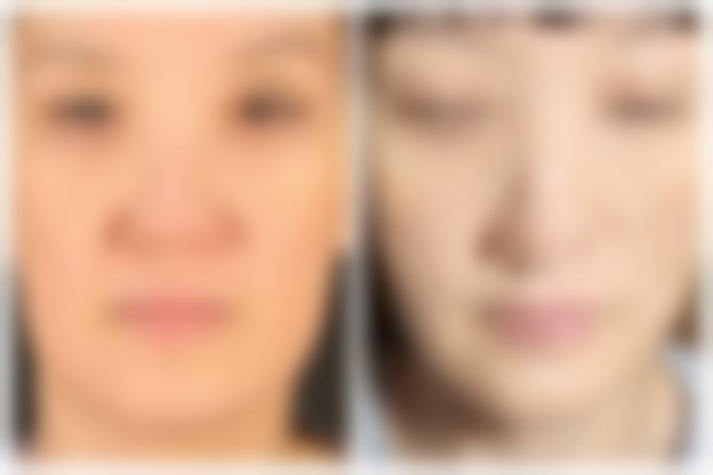 上镜嘴巴歪怎么改正？掌握医美4大妙招，告别歪嘴尴尬，让你上镜颜值直线飙升！ 