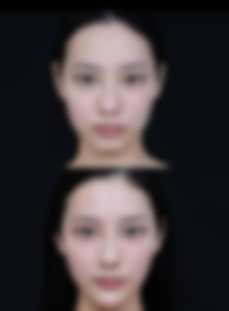 如何选择适合自己的颌面整形医院和医生