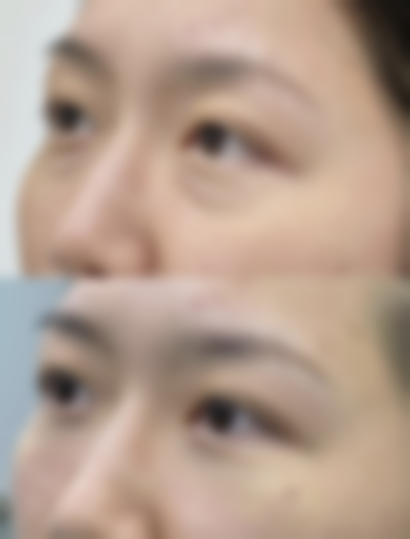 毛发种植的危害有哪些呢