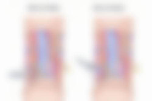 瘦脸针能不能瘦脂肪