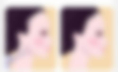 瘦脸针打完多久见效