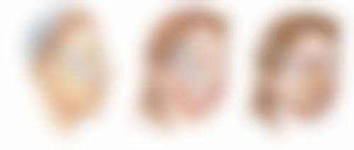 种植头发哪家医院好