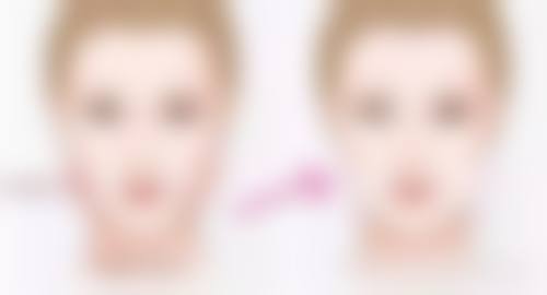 种植发际线多久能长出来？揭秘30 - 90天的生长黄金期，让你轻松拥有自然浓密发际线！ 