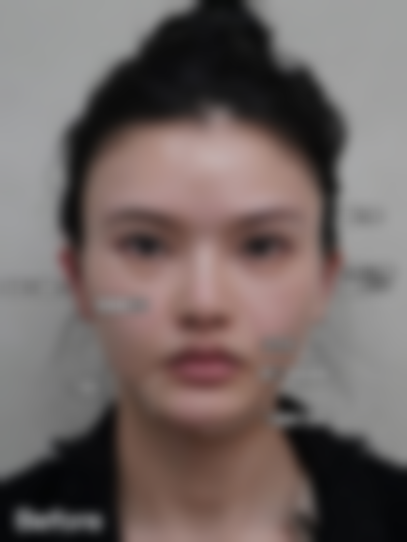 【刘拴锁医生擅长项目:】