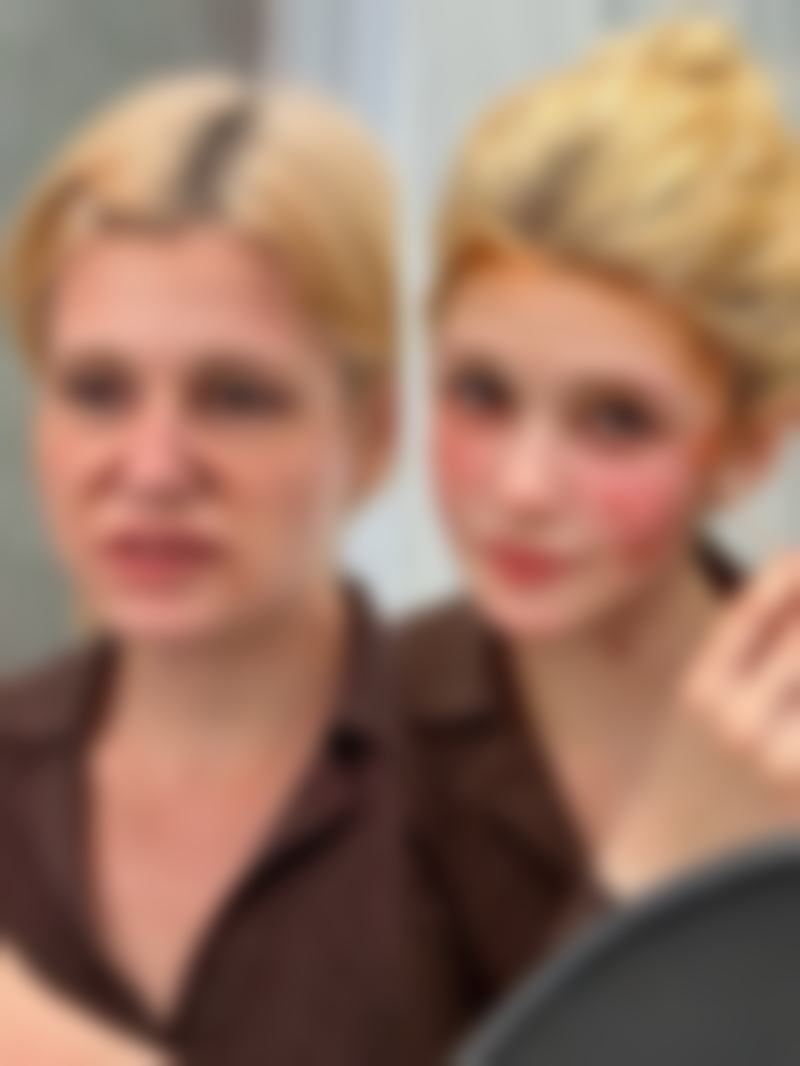 打瘦脸针后要注意哪些事项