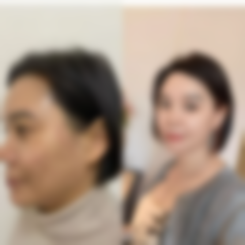 【李光农医生技术特点】