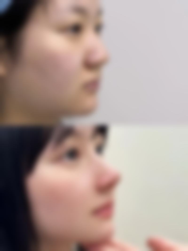 【无锡艾谜整形医院特色项目:】