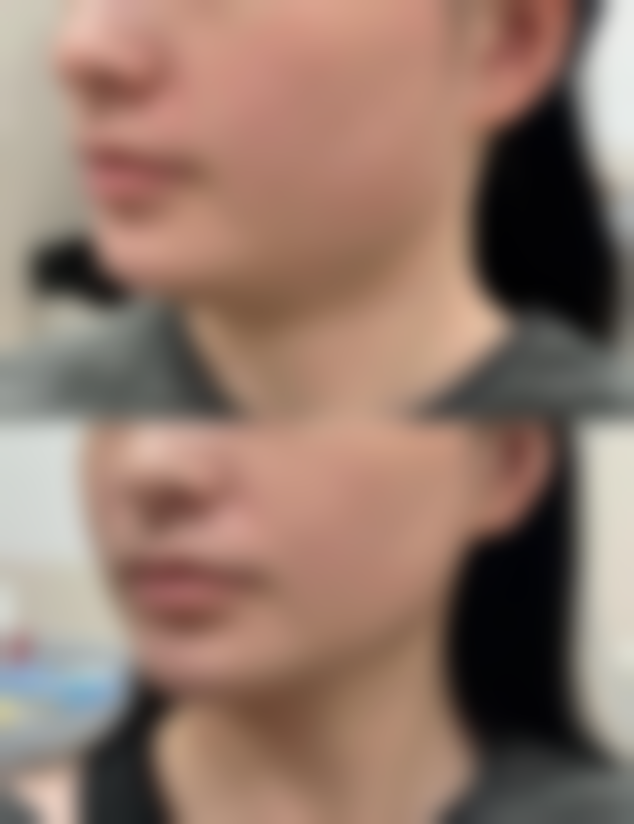 【台州博仕整形美容医院诊疗设备：】