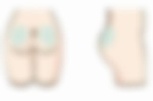 阴道紧缩术能改善外阴、前庭部及阴道环部的萎缩性病变吗