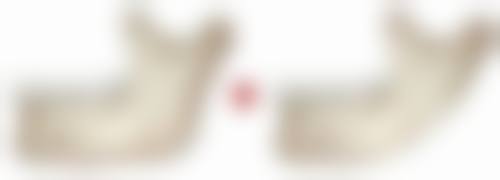 什么人不适合注射除皱针