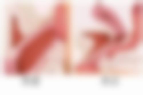 阴道紧缩术的未来发展趋势