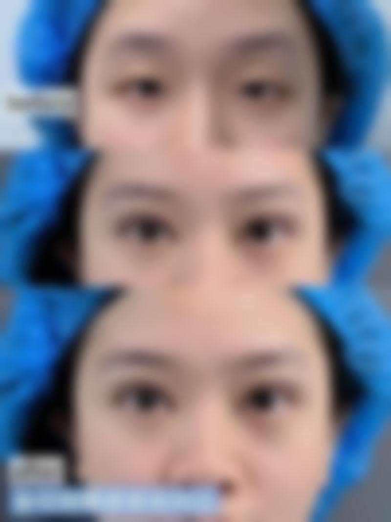 【河南安和医疗美容门诊部参考价格表：】