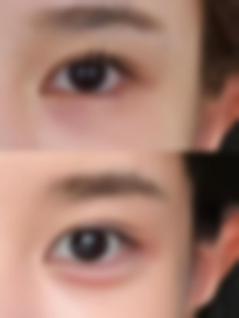 阴道紧缩术还能生孩子吗？权威解析术后生育可行性，3大关键因素揭秘，让你安心迎接新生命！ 