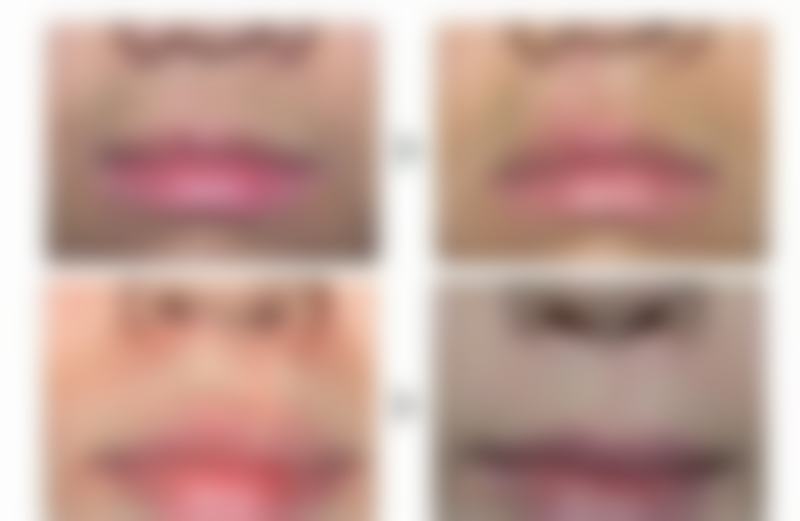 【 南宁樱之炫身心灵医疗美容诊所特色项目：】