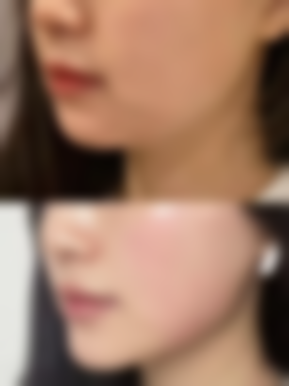 【天津威莎恒美医疗美容门诊部特色项目:】