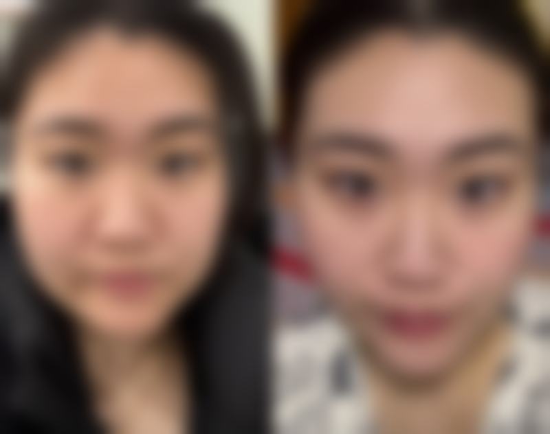 【 南宁樱之炫身心灵医疗美容诊所患者口碑评价：】