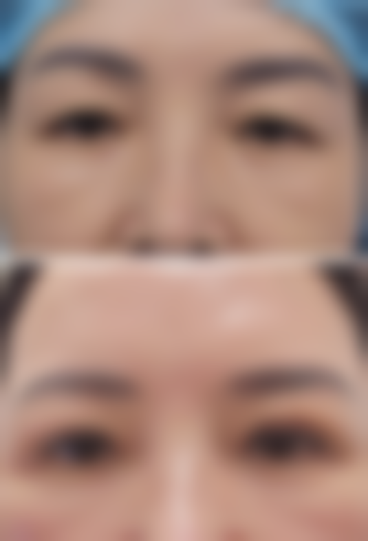 眼袋的克星是什么药膏