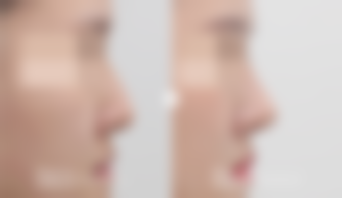 【韩国玉芭整形外科医院参考价格表：】