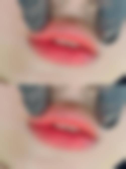 【佛山壹加壹医疗美容医院患者口碑评价:】