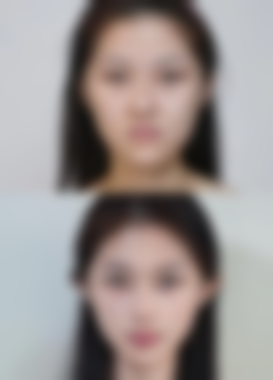 毛发种植单价是多少？揭秘影响价格的5大因素，让你明白消费，轻松拥有浓密毛发！ 