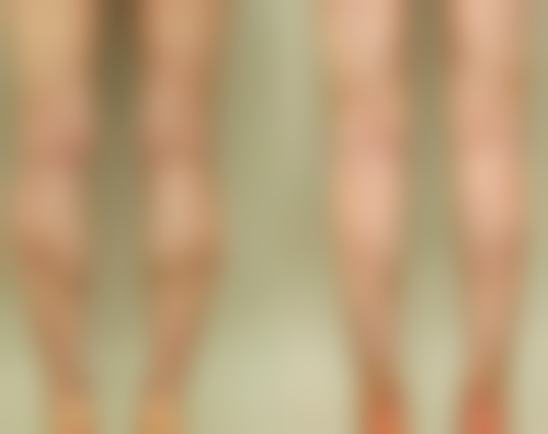 阴道紧缩丸有什么副作用？揭秘3大潜在风险及应对策略，让你安全享受医美紧致效果！ 