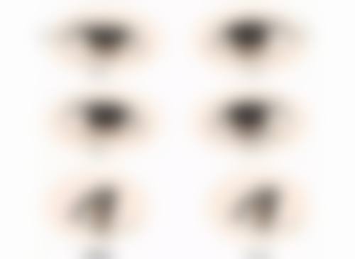 瘦脸针打几次就恒久了