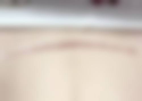 【深圳同仁医院整形科是正规的吗?】