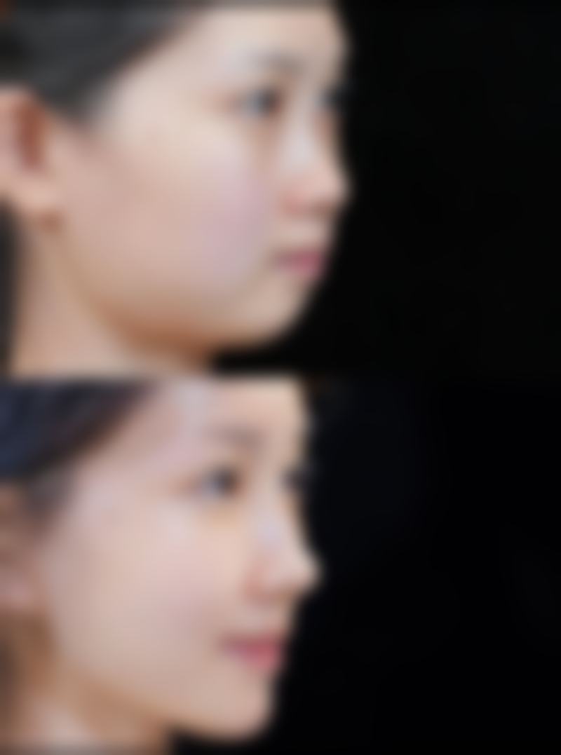 【俞律峰医生怎么预约挂号？】