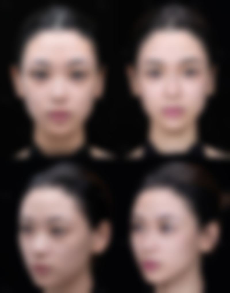 【广州青逸医疗美容门诊部参考价格表：】