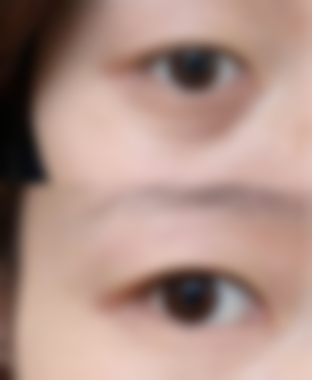 【贵阳妍希尔柒玖整形医院特色项目：】