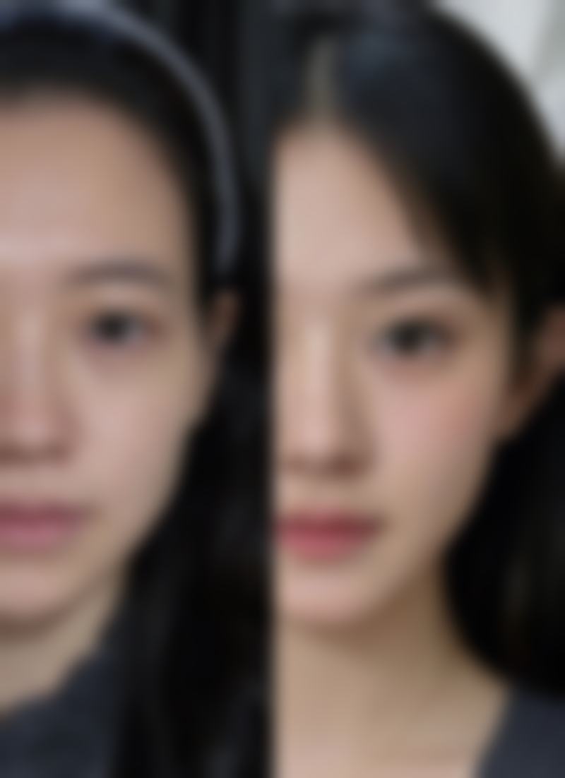 阴道紧缩针多少钱