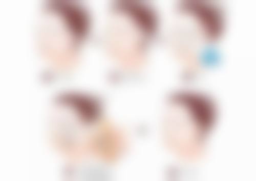 丰太阳穴的常见问题解答