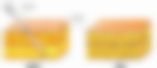 嘴太小能整形变大吗图片和视频