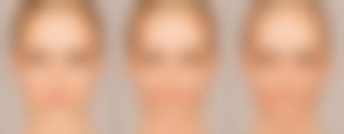 不同整形方式的价格及优势