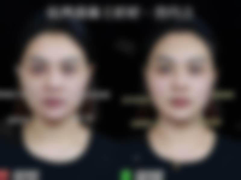 【方娅医生口碑怎么样？】