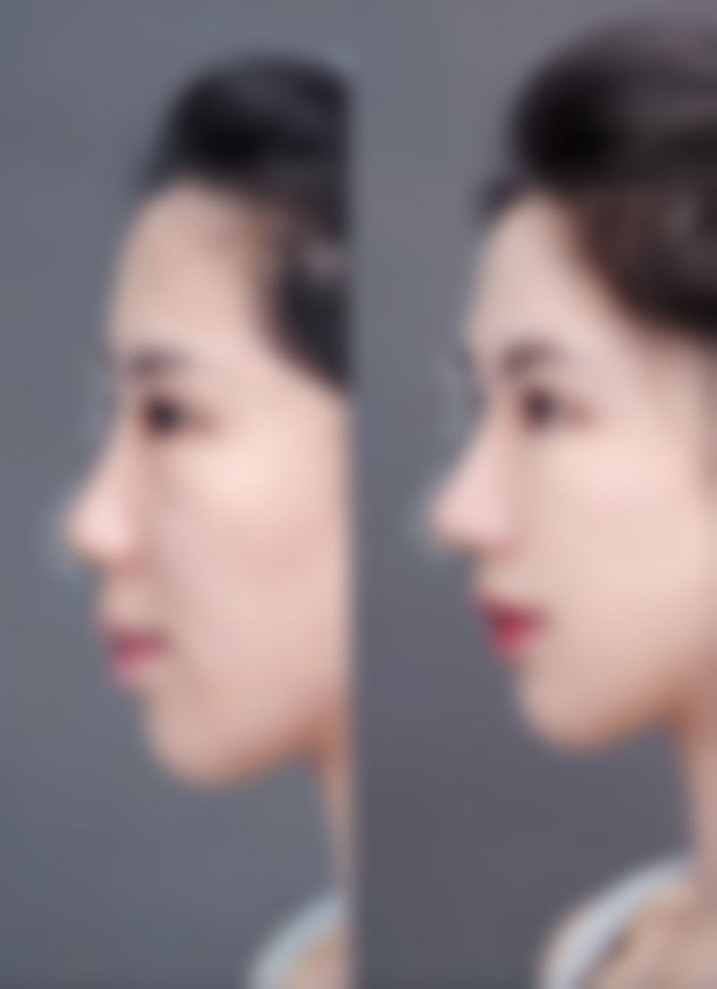 【孙丽君医生擅长项目】