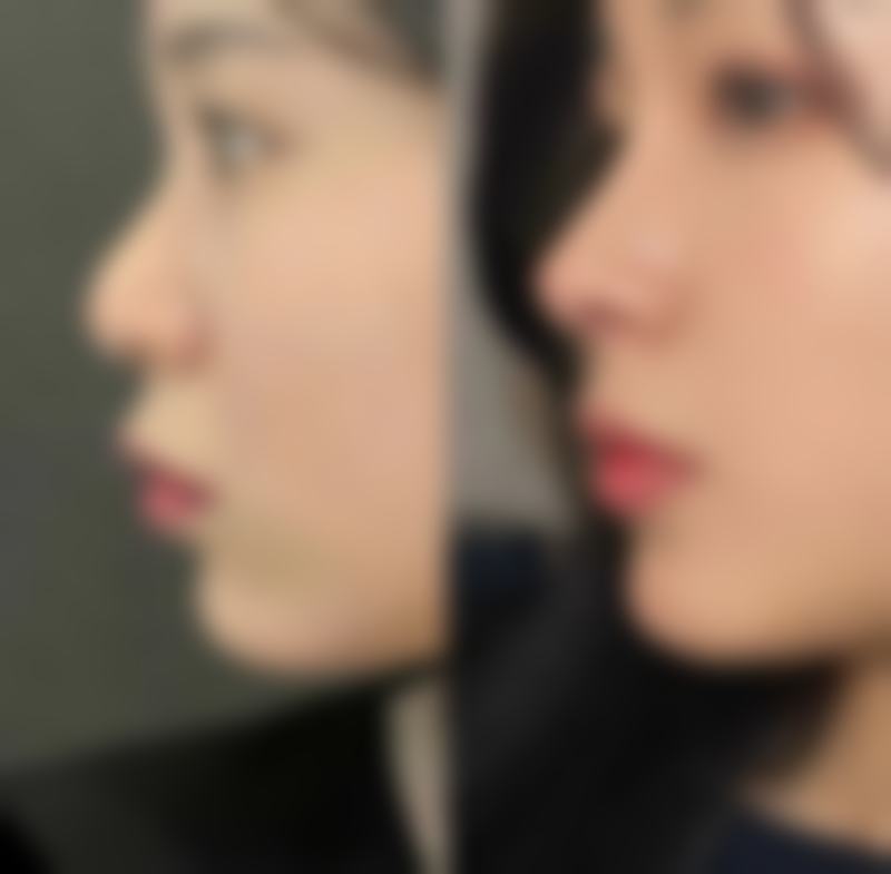 【韩国普瑞美整形外科医生名单：】